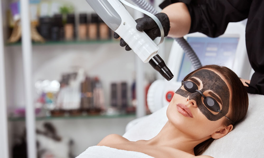 Tratamiento Carbon peel en el centro de estética Ivela Beauty Concept de Valladolid